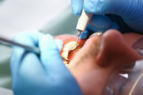 Best Emergency Root Canal Treatment in Hutchins, TX