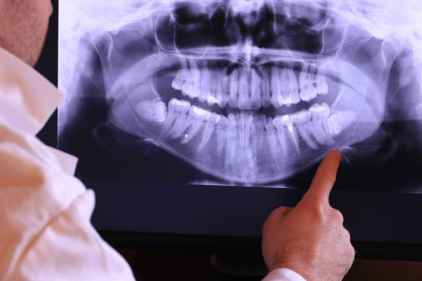 Best Emergency Tooth Extraction in Hutchins, TX